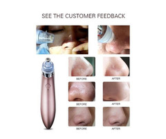 Dermasuction Skin Vacuum Cleaner - Image 10/10