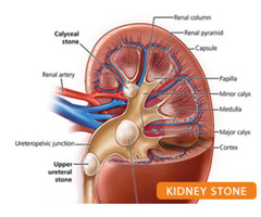 Best Nephrologist in Patna Bihar: Dr. Kumar Rajesh Ranjan - Image 1/4