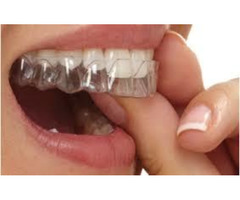 Teeth Straightening Aligners, Clear Teeth Straighteners - Image 5/7