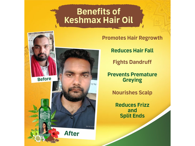 Keshmax Ayurvedic Hair Oil Testimonial video By Saheli  Hindi  Keshmax  Ayurvedic Hair Oil  Indias First Chemical Free hair Oil  Complete  Ayurvedic Treatment for Hair Fall and Regrowth new