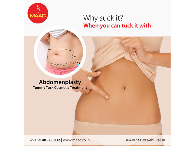 Cosmetic surgery in bangalore - 9/10
