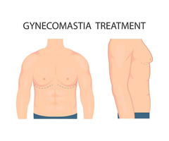 Thing you need to know about Gynecomastia Surgery – Stages, costs and types