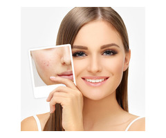 Skin Specialist in Pune - Image 2/4