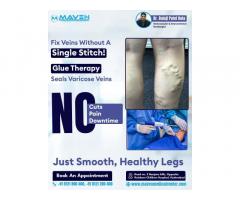 Best Varicose veins laser treatment | Best varicose veins laser treatment in Hyderabad
