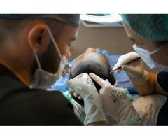 Permanent Hair Replacement | Natural & Long-Lasting Hair Solutions