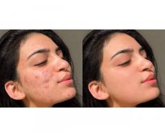 Photo retouching service