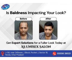Say Goodbye to Baldness with Natural Hair Patch in Noida at AS Unisex Salon