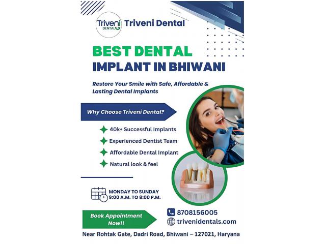 Best Dental Implant in Bhiwani | Triveni Dental - 1/1