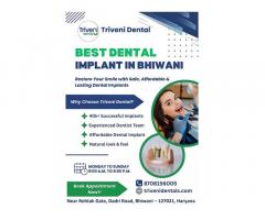 Best Dental Implant in Bhiwani | Triveni Dental