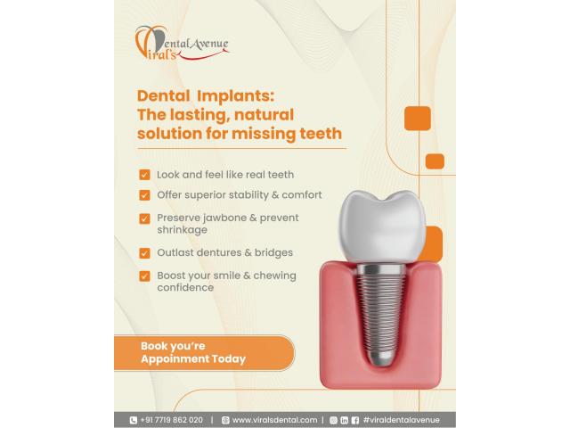 Restore Your Smile with the Best Dental Implants in Mulund - 1/1