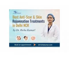 Best Anti-Scar & Skin Rejuvenation Treatments in Delhi NCR by Dr. Richa Kumar!
