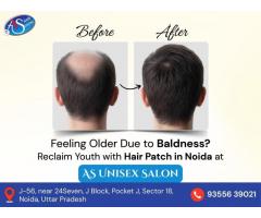 Restore Your Look with the Most Natural Hair Patch in Noida.