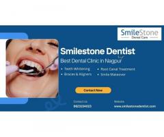 Smilestone Dentist - Best Dental Clinic in Nagpur