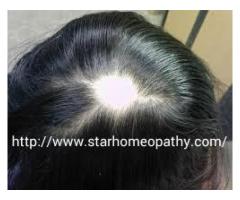 Homeopathic Doctors For Alopecia , Homeopathy Treatment For Alopecia - Image 1/3
